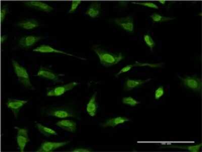 Immunocytochemistry/ Immunofluorescence: RNF2 Antibody (3B8) [H00006045-M08]