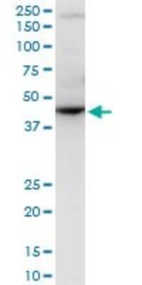 Western Blot: RNF2 Antibody (3B8) [H00006045-M08]