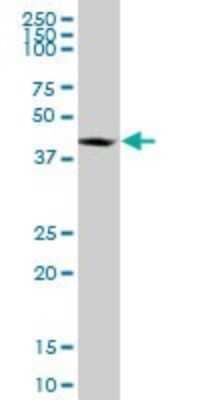 Western Blot: RNF2 Antibody (3B8) [H00006045-M08]