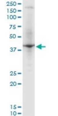 Western Blot: RNF2 Antibody (3G6) [H00006045-M03]