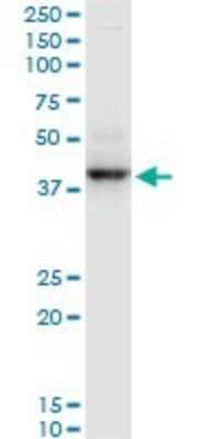 Western Blot: RNF2 Antibody (3G6) [H00006045-M03]