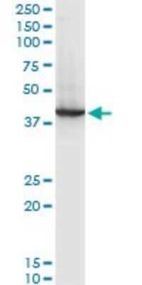 Western Blot: RNF2 Antibody (3G6) [H00006045-M03]