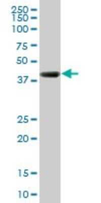 Western Blot: RNF2 Antibody (3G6) [H00006045-M03]
