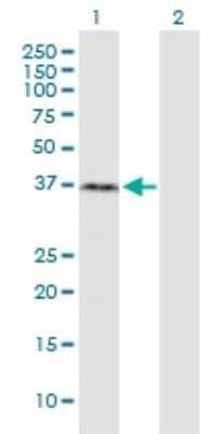 Western Blot: RNF2 Antibody (3G6) [H00006045-M03]