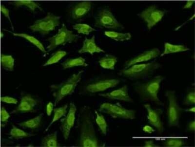 Immunocytochemistry/ Immunofluorescence: RNF2 Antibody (4A9) [H00006045-M06]