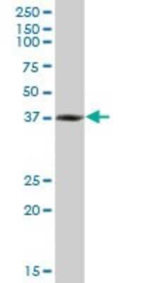 Western Blot: RNF2 Antibody (4A9) [H00006045-M06]