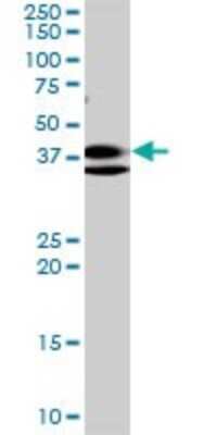 Western Blot: RNF2 Antibody (6C2) [H00006045-M01]