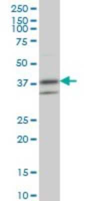 Western Blot: RNF2 Antibody (6C2) [H00006045-M01]
