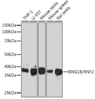 Western Blot: RNF2 Antibody (9Q2W2) [NBP3-16222]