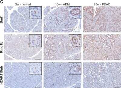 Immunohistochemistry: RNF2 Antibody [NBP1-49966]