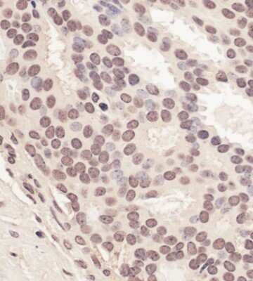 Immunohistochemistry-Paraffin: RNF2 Antibody [NBP1-49966]