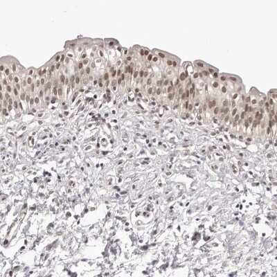 Immunohistochemistry-Paraffin: RNF2 Antibody [NBP1-88712]