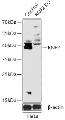 Knockout Validated: RNF2 Antibody - Azide and BSA Free [NBP3-03455]