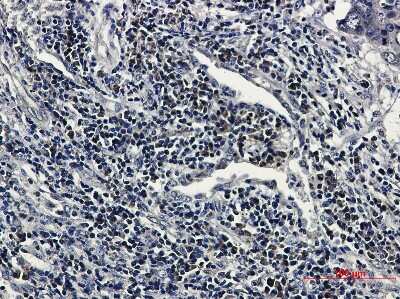 Immunohistochemistry: RNF2 Antibody (S04-2B3) [NBP3-14971]