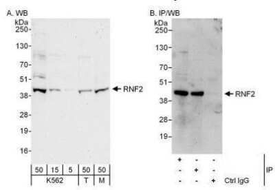 Western Blot: RNF2 Antibody [NBP1-49966]