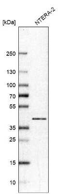 Western Blot: RNF2 Antibody [NBP1-88712]