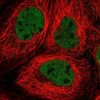 Immunocytochemistry/ Immunofluorescence: RNF20 Antibody [NBP2-54995]