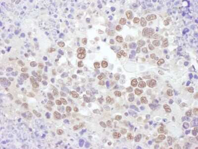 Immunohistochemistry-Paraffin: RNF20 Antibody [NB100-2243]