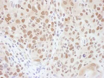 Immunohistochemistry-Paraffin: RNF20 Antibody [NB100-2243]