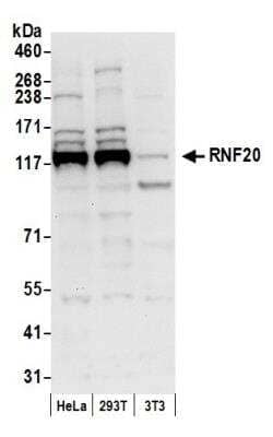 Western Blot: RNF20 Antibody [NB100-2242]