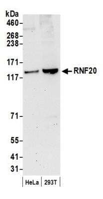 Western Blot: RNF20 Antibody [NB100-2243]