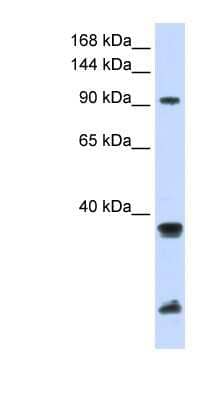 Western Blot: RNF20 Antibody [NBP1-52945]