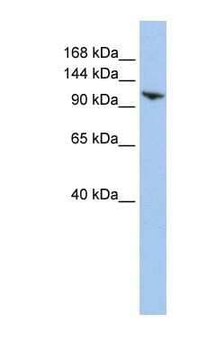 Western Blot: RNF20 Antibody [NBP1-52985]