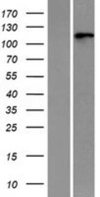 Western Blot: RNF20 Overexpression Lysate [NBP2-06703]