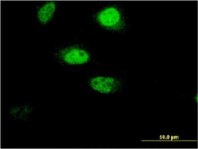 Immunocytochemistry/ Immunofluorescence: RNF207 Antibody (1C5) [H00388591-M02]