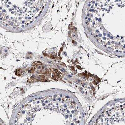 Immunohistochemistry: RNF208 Antibody [NBP1-90502]