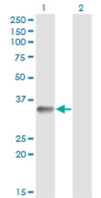 Western Blot: RNF212 Antibody (5H3) [H00285498-M01]