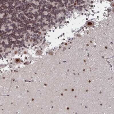 Immunohistochemistry: RNF212 Antibody [NBP2-49259]