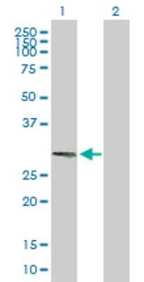 Western Blot: RNF212 Antibody [H00285498-B01P]