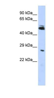 Western Blot: RNF212 Antibody [NBP1-55083]