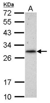 Western Blot: RNF212 Antibody [NBP2-20182]