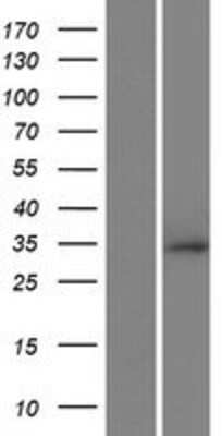 Western Blot: RNF212 Overexpression Lysate [NBP2-09530]