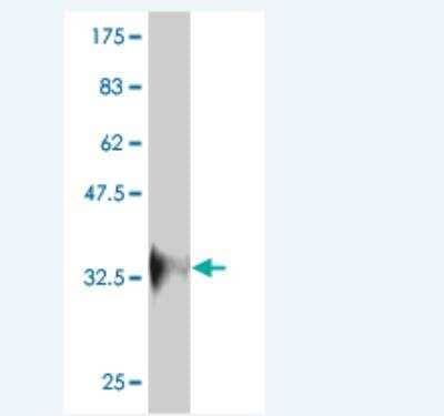 Western Blot: RNF213 Antibody (5C12) [H00057674-M01]