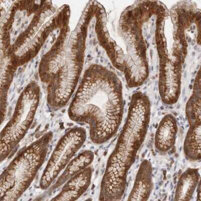 Immunohistochemistry-Paraffin: RNF213 Antibody [NBP1-88465]