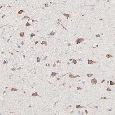 Immunohistochemistry-Paraffin: RNF213 Antibody [NBP1-88466]