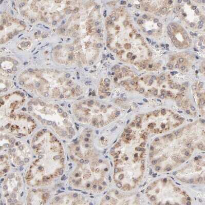 Immunohistochemistry-Paraffin: RNF213 Antibody [NBP1-88466]