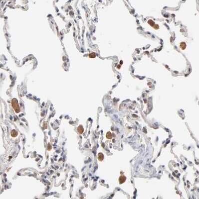 Immunohistochemistry-Paraffin: RNF213 Antibody [NBP1-88466]