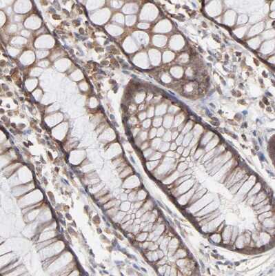 Immunohistochemistry-Paraffin: RNF213 Antibody [NBP1-88466]