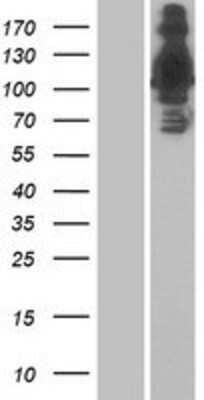 Western Blot: RNF213 Overexpression Lysate [NBP2-06582]