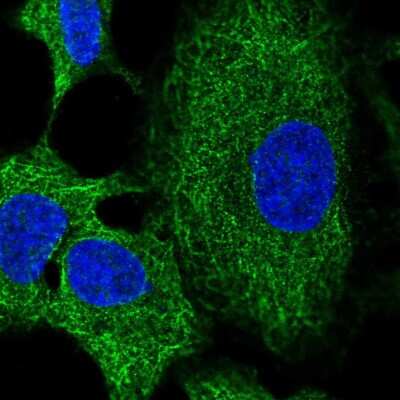 Immunocytochemistry/ Immunofluorescence: RNF215 Antibody [NBP2-58576]