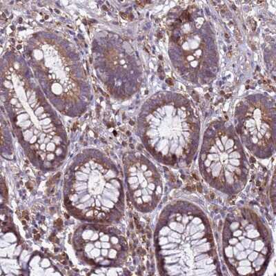 Immunohistochemistry: RNF215 Antibody [NBP2-68609]