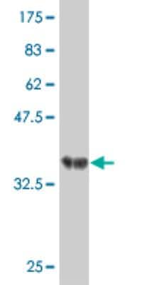 Western Blot: RNF219 Antibody (1B1) [H00079596-M06]