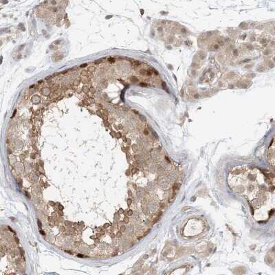 Immunohistochemistry-Paraffin: RNF219 Antibody [NBP1-88401]