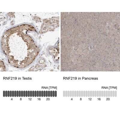 Immunohistochemistry-Paraffin: RNF219 Antibody [NBP1-88401]
