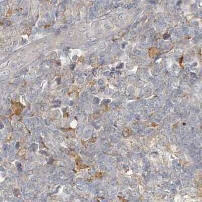 Immunohistochemistry-Paraffin: RNF219 Antibody [NBP1-88401]