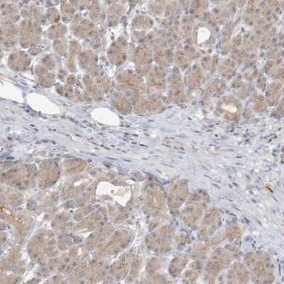 Immunohistochemistry-Paraffin: RNF219 Antibody [NBP2-33979]